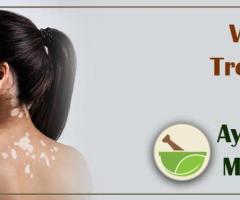 AROGYAM PURE HERBS KIT FOR VITILIGO